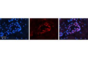 Rabbit Anti-PAX8 Antibody   Formalin Fixed Paraffin Embedded Tissue: Human Thyroid Tissue Observed Staining: Nucleus in follicular cells Primary Antibody Concentration: 1:100 Other Working Concentrations: 1:600 Secondary Antibody: Donkey anti-Rabbit-Cy3 Secondary Antibody Concentration: 1:200 Magnification: 20X Exposure Time: 0. (PAX8 抗体  (N-Term))
