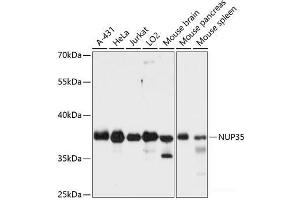 Western blot analysis of extracts of various cell lines using NUP35 Polyclonal Antibody at dilution of 1:3000. (NUP35 抗体)