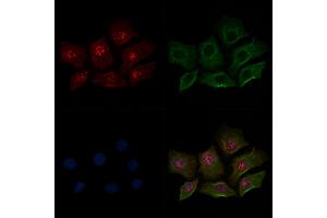 ABIN6255402 and ABIN6267070 staining HepG2 cells(30 min of 4uM Forskolin treatment) by IF/ICC.