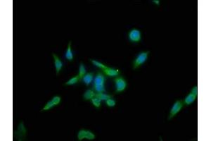 Immunofluorescence staining of PC-3 cells with ABIN7157267 at 1:133, counter-stained with DAPI. (KLHL12 抗体  (AA 1-220))