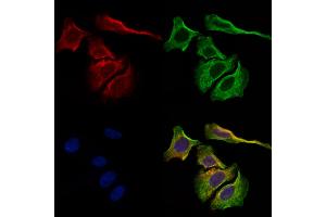 ABIN7093128 and ABIN7098914 staining Hela cells by IF/ICC. (kappa Light Chain 抗体)