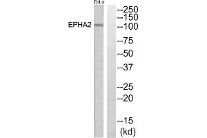 Western blot analysis of extracts from COLO205 and Jurkat cells, using EPHA2 antibody. (EPH Receptor A2 抗体  (N-Term))