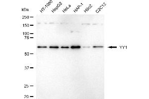 Western blotting analysis using YY1 antibody (ABIN7800886).