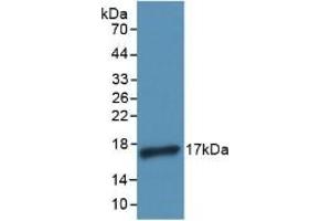 Detection of Recombinant IL4, Human using Polyclonal Antibody to Interleukin 4 (IL4) (IL-4 抗体  (AA 25-153))