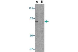 Western blot analysis of AICDA in Ramos whole cell lysate with AICDA polyclonal antibody  at 2 ug/mL in either the (A) absence or (B) presence of blocking peptide. (AICDA 抗体  (C-Term))