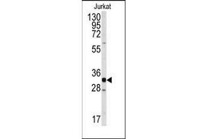 Western blot analysis of anti-CDK2 Antibody (C-term) in Jurkat cell line lysates (35ug/lane). (CDK2 抗体  (C-Term))