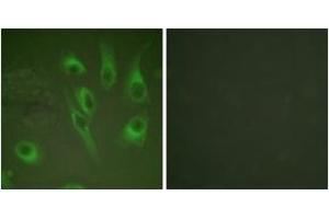 Immunofluorescence analysis of HeLa cells, using Calnexin (Phospho-Ser583) Antibody. (Calnexin 抗体  (pSer583))
