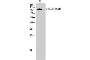 Western Blotting (WB) image for anti-EPH Receptor A7 (EPHA7) (pTyr791) antibody (ABIN3173153) (EPH Receptor A7 抗体  (pTyr791))