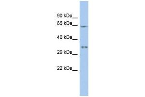 MIF4GD antibody used at 1 ug/ml to detect target protein. (MIF4GD 抗体  (N-Term))