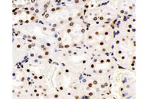 Immunohistochemistry analysis of paraffin-embedded Rat kidney using S100A4 Polyclonal Antibody at dilution of 1:400. (s100a4 抗体)