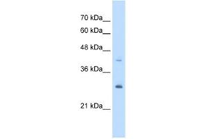 WB Suggested Anti-CACYBP Antibody Titration:  5. (CACYBP 抗体  (Middle Region))