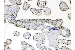 Immunohistochemistry (IHC) image for anti-Aldo-Keto Reductase Family 1, Member B1 (Aldose Reductase) (AKR1B1) (AA 228-316) antibody (ABIN4886447)