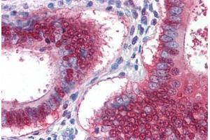Human Uterus: Formalin-Fixed, Paraffin-Embedded (FFPE) (YAP1 抗体  (AA 53-162))