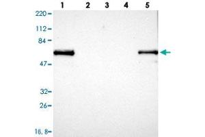 Western blot analysis of Lane 1: RT-4, Lane 2: U-251 MG, Lane 3: Human Plasma, Lane 4: Liver, Lane 5: Tonsil with LRMP polyclonal antibody . (LRMP 抗体)
