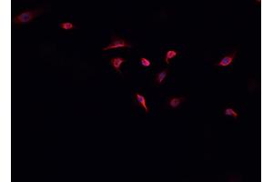 ABIN6268885 staining A-431 cells by IF/ICC. (HSPH1 抗体  (C-Term))