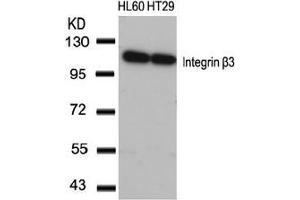Image no. 3 for anti-Integrin beta 3 (ITGB3) (AA 771-775) antibody (ABIN197246) (Integrin beta 3 抗体  (AA 771-775))