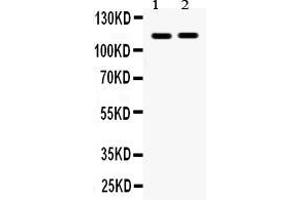 Anti- Eph receptor A5 Picoband antibody, Western blottingAll lanes: Anti Eph receptor A5  at 0. (EPH Receptor A5 抗体  (C-Term))