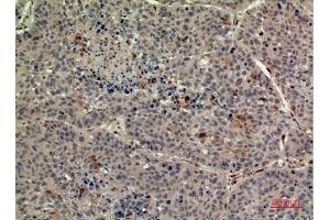 Immunohistochemical analysis of paraffin-embedded human-liver, antibody was diluted at 1:100. (TPO (Internal Region) 抗体)