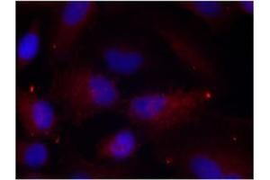 Image no. 1 for anti-P21-Activated Kinase 1 (PAK1) (pThr402), (pThr421), (pThr423) antibody (ABIN196896) (PAK1 抗体  (pThr402, pThr421, pThr423))