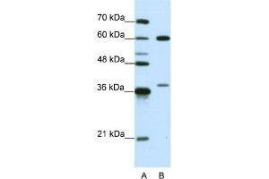 WB Suggested Anti-HNRPL Antibody Titration:  0. (HNRNPL 抗体  (N-Term))