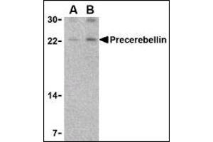 Image no. 4 for anti-Cerebellin 1 Precursor (CBLN1) (Middle Region) antibody (ABIN303204) (CBLN1 抗体  (Middle Region))