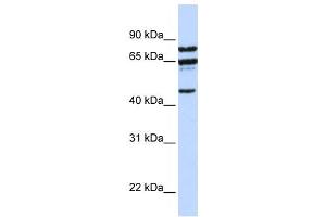 Western Blotting (WB) image for anti-Protein Phosphatase 4, Regulatory Subunit 2 (PPP4R2) antibody (ABIN2458684) (PPP4R2 抗体)