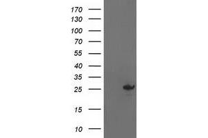 HEK293T cells were transfected with the pCMV6-ENTRY control (Left lane) or pCMV6-ENTRY AK4 (Right lane) cDNA for 48 hrs and lysed. (AK4 抗体)