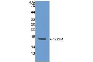 Detection of Recombinant CEA, Mouse using Polyclonal Antibody to Carcinoembryonic Antigen (CEA) (CEA 抗体  (AA 85-222))