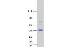 Validation with Western Blot