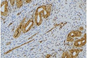 ABIN6276508 at 1/100 staining Human uterus tissue by IHC-P. (SPINK1 抗体  (Internal Region))