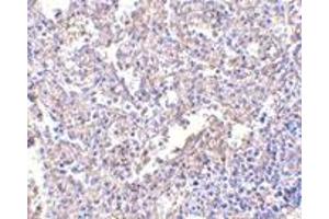 Immunohistochemistry (IHC) image for anti-Lymphocyte Antigen 96 (LY96) antibody (ABIN1031731) (LY96 抗体)
