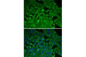 Immunofluorescence analysis of A-549 cells using EEF2K antibody (ABIN6130354, ABIN6139955, ABIN6139956 and ABIN7101771). (EEF2K 抗体  (AA 406-725))