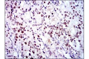 Immunohistochemistry (IHC) image for anti-Cyclin-Dependent Kinase 2 (CDK2) antibody (ABIN1845617) (CDK2 抗体)