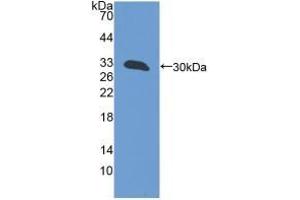 Detection of Recombinant GFM1, Mouse using Polyclonal Antibody to G-Elongation Factor, Mitochondrial 1 (GFM1) (GFM1 抗体  (AA 511-751))