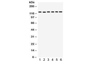 Western blot testing of 1) rat lung, 2) mouse lung, 3) rat brain, 4) human U20S, 5) human HeLa, 6) mouse NIH3T3 lysate with FAK antibody.