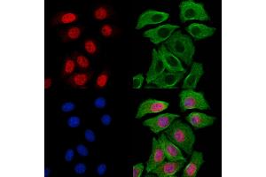 ABIN7094277 and ABIN7098324 staining Hela cells by IF/ICC.