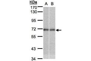 Western Blotting (WB) image for anti-Nuclear Receptor Subfamily 2, Group C, Member 2 (NR2C2) antibody (ABIN2856042)