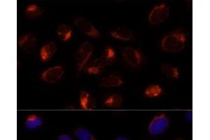 Immunofluorescence analysis of U-2 OS cells using TXNDC12 Polyclonal Antibody at dilution of 1:100 (40x lens). (TXNDC12 抗体)