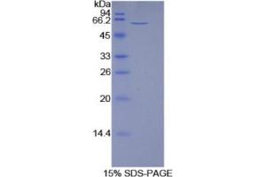 SDS-PAGE analysis of Rat 5'-Nucleotidase, Ecto Protein. (CD73 蛋白)