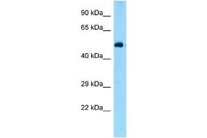 WB Suggested Anti-Zbtb44 Antibody Titration: 1. (ZBTB44 抗体  (N-Term))