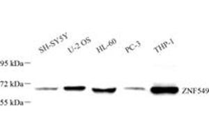 Western blot analysis of ZNF549 (ABIN7076267) at dilution of 1: 1000 (ZNF549 抗体)