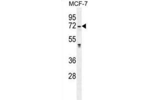 Western Blotting (WB) image for anti-Galactosamine (N-Acetyl)-6-Sulfate Sulfatase (GALNS) antibody (ABIN2996293) (GALNS 抗体)