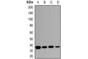 Western blot analysis of Carbonic Anhydrase 13 expression in HepG2 (A), HCT116 (B), mouse intestines (C), rat intestines (D) whole cell lysates. (CA13 抗体)