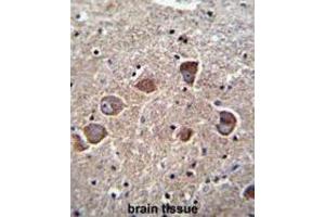Immunohistochemistry (IHC) image for anti-Phosphatidic Acid Phosphatase Type 2 Domain Containing 1A (PPAPDC1A) antibody (ABIN2996072) (PPAPDC1A 抗体)