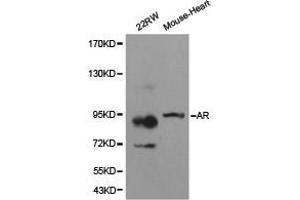 Western Blotting (WB) image for anti-Androgen Receptor (AR) antibody (ABIN1871059)