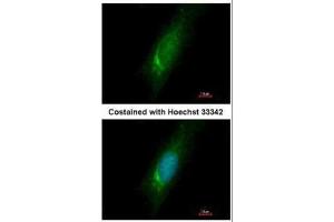 ICC/IF Image Immunofluorescence analysis of methanol-fixed HeLa, using Homer3, antibody at 1:500 dilution. (HOMER3 抗体  (Center))