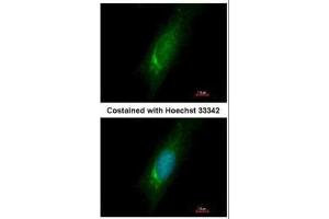 ICC/IF Image Immunofluorescence analysis of methanol-fixed HeLa, using Homer3, antibody at 1:500 dilution.