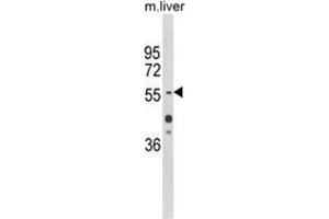 Western blot analysis of HNF1A Antibody (Center) in mouse liver tissue lysates (35ug/lane). (HNF1A 抗体  (Middle Region))