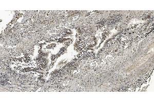 IHC analysis of HP1 alpha/CBX5 using anti-HP1 alpha/CBX5 antibody (ABIN7599057).