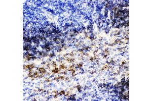 Anti- CD79B picoband antibody,IHC(P) IHC(P): Mouse Spleen Tissue (CD79b 抗体  (AA 29-229))